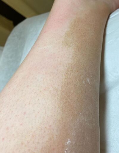 Spa at Banksia - Alexandria Body Sugaring