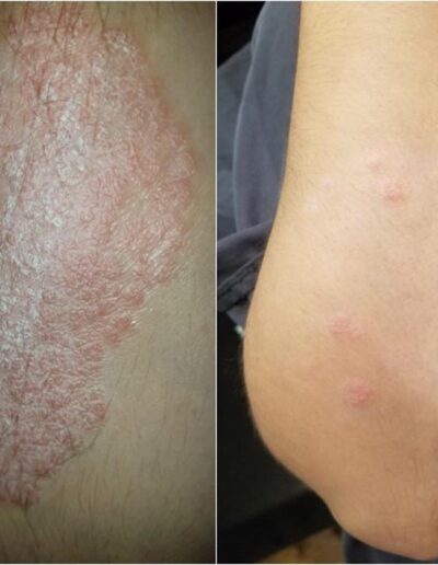 Spa at Banksia - Before and After