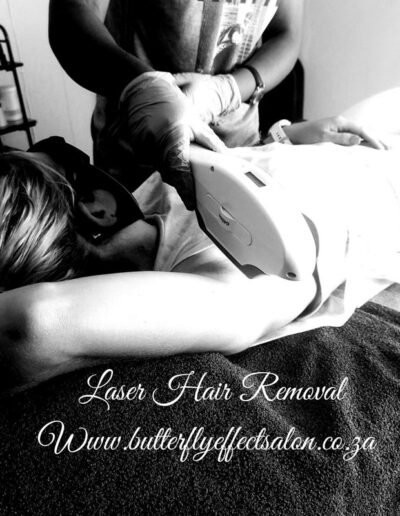Butterfly Effect Beauty - Laser Hair Removal - Before and After