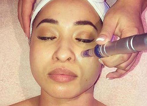 Microneedling - Beauty Cafe Icon