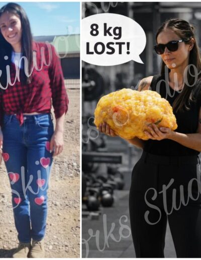 Skinworks Studio - Before and After Weight Loss - 8kg lost