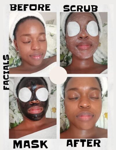 Essence of Youth - Before and After - Mask and Scrub Treatment