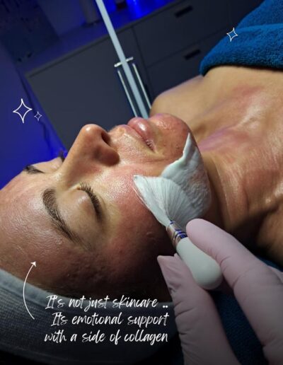 Synergy Skin and Body Studio - Microneedling - not just skincare