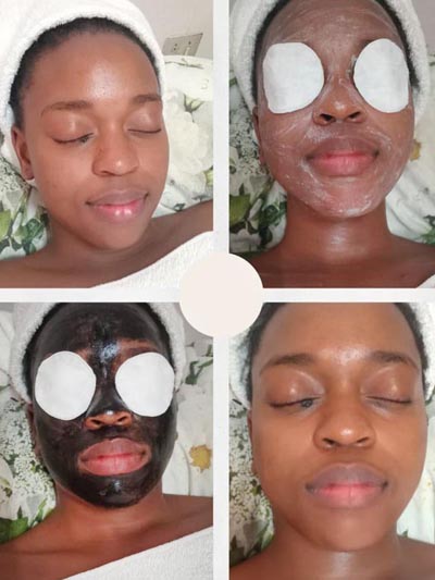 Showcase - Essence of Youth - Before and After - Mask and Scrub Treatment