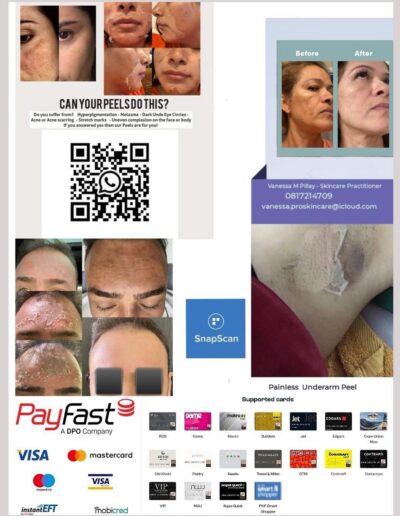 Professional Skin Peels - Collage a
